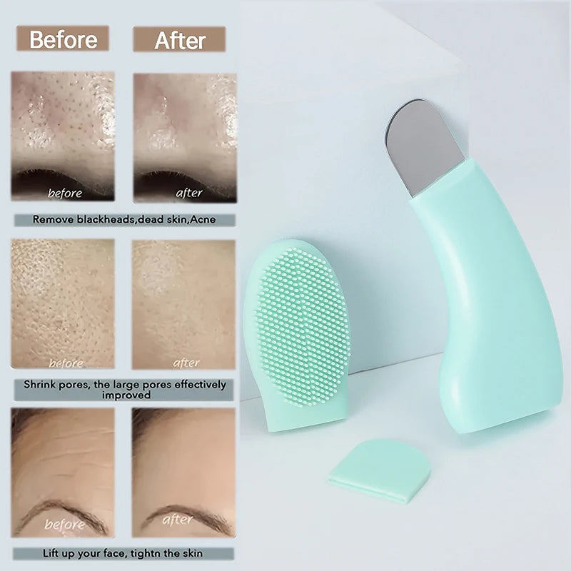 GloGrit Portable Skin Exfoliator